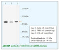 Anti-ABCB5 Antibody – Figure 1 of 1