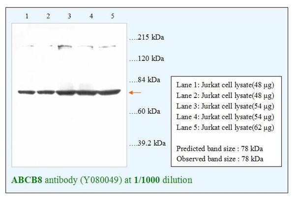 Anti-ABCB8 Antibody – Figure 1 of 1