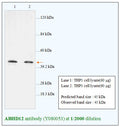 Anti-ABHD12 Antibody – Figure 1 of 1