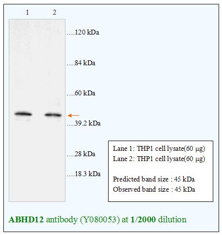 Anti-ABHD12 Antibody – Figure 1 of 1