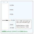 Anti-ABHD6 Antibody – Figure 1 of 1