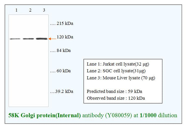 Anti-58K Golgi protein(Internal) Antibody – Figure 1 of 1