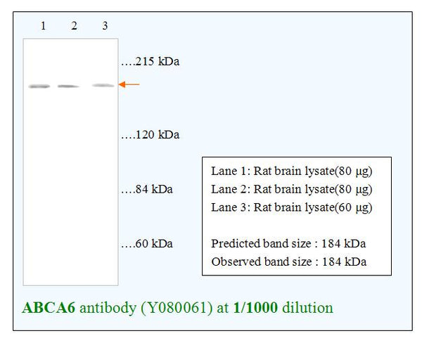 Anti-ABCA6 Antibody – Figure 1 of 1