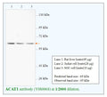 Anti-ACAT1 Antibody – Figure 1 of 1