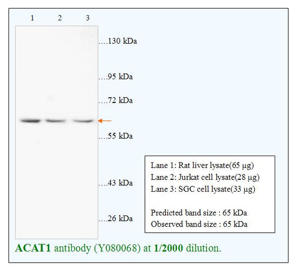 Anti-ACAT1 Antibody – Figure 1 of 1