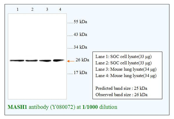 Anti-MASH1 Antibody – Figure 1 of 1