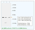 Anti-ACADM Antibody – Figure 1 of 1