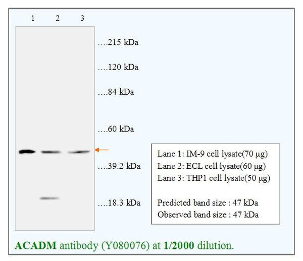Anti-ACADM Antibody – Figure 1 of 1