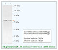Anti-5 Lipoxygenase(5 LO) Antibody – Figure 1 of 1