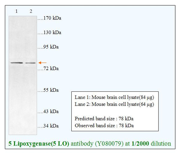 Anti-5 Lipoxygenase(5 LO) Antibody – Figure 1 of 1