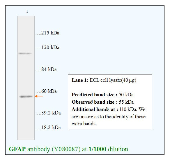 Anti-GFAP Antibody – Figure 1 of 1