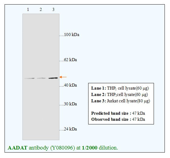 Anti-AADAT Antibody – Figure 1 of 1