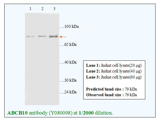 Anti-ABCB10 Antibody – Figure 1 of 1