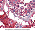 Anti-GSTA3 Antibody – Figure 1 of 2