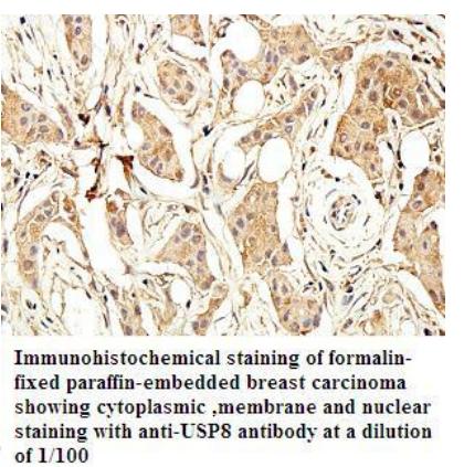 Anti-USP8 Antibody – Figure 1 of 1