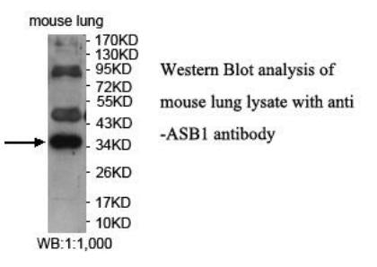 Anti-ASB1 Antibody – Figure 1 of 1
