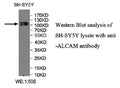 Anti-ALCAM Antibody – Figure 1 of 1