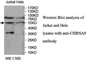 Anti-CHRNA9 Antibody – Figure 1 of 1