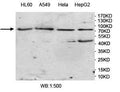 Anti-VWA2 Antibody – Figure 1 of 1