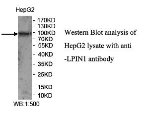 Anti-LPIN1 Antibody – Figure 1 of 1