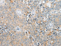 COMMD6 Polyclonal Antibody – Figure 1 of 3