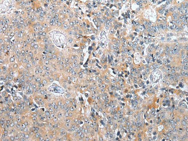 COMMD6 Polyclonal Antibody – Figure 1 of 3