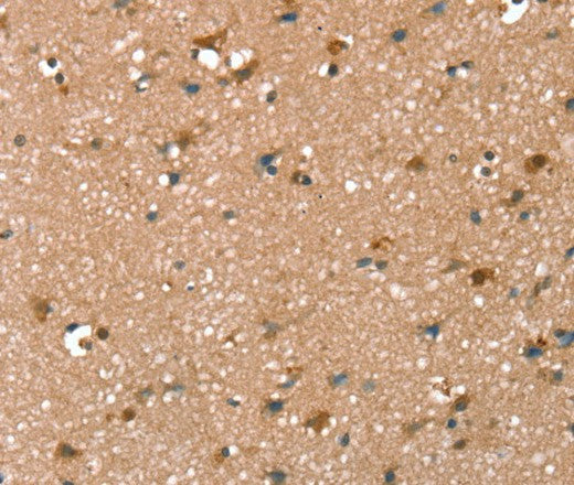 SYNPO2 Polyclonal Antibody – Figure 1 of 3
