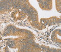 ARHGAP15 Polyclonal Antibody – Figure 1 of 3