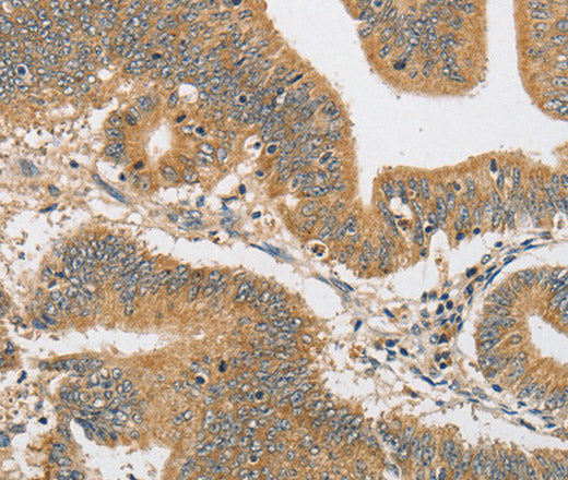 ARHGAP15 Polyclonal Antibody – Figure 1 of 3