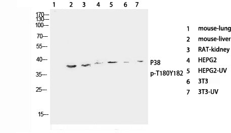 Phospho-P38 (Thr180/Tyr182) Polyclonal Antibody – Figure 1 of 4