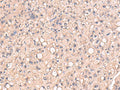 RIOK1 Polyclonal Antibody – Figure 1 of 2