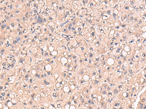 RIOK1 Polyclonal Antibody – Figure 1 of 2