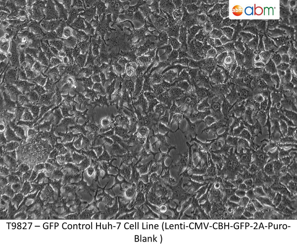 GFP Expressing Huh-7 Stable Cell Line | Applied Biological Materials (abm)
