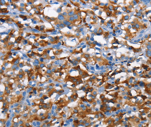 CD226 Polyclonal Antibody – Figure 1 of 3