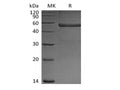 Recombinant Mouse Pentraxin-related protein PTX3(N-6His) – Figure 1 of 2
