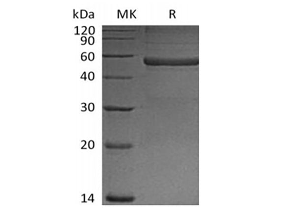 Recombinant Mouse Pentraxin-related protein PTX3(N-6His) – Figure 1 of 2