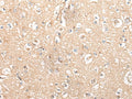 MTNR1B Polyclonal Antibody – Figure 1 of 3