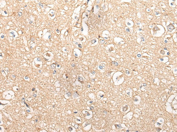 MTNR1B Polyclonal Antibody – Figure 1 of 3