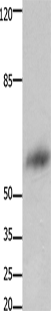 FOXJ3 Polyclonal Antibody – Figure 1 of 2