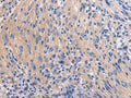 GALR3 Polyclonal Antibody – Figure 1 of 3