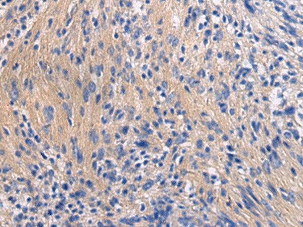 GALR3 Polyclonal Antibody – Figure 1 of 3