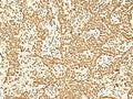 ILF3 Polyclonal Antibody – Figure 1 of 3