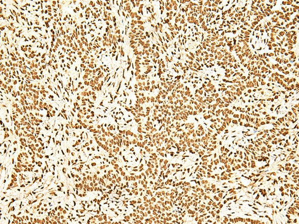 ILF3 Polyclonal Antibody – Figure 1 of 3