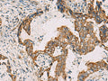 PDHA1 Polyclonal Antibody – Figure 1 of 3
