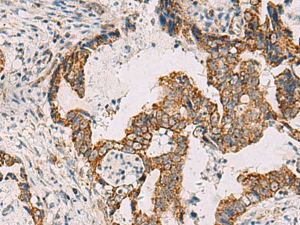 PDHA1 Polyclonal Antibody – Figure 1 of 3