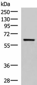 SARS Polyclonal Antibody – Figure 1 of 3