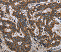 LGALS2 Polyclonal Antibody – Figure 1 of 3