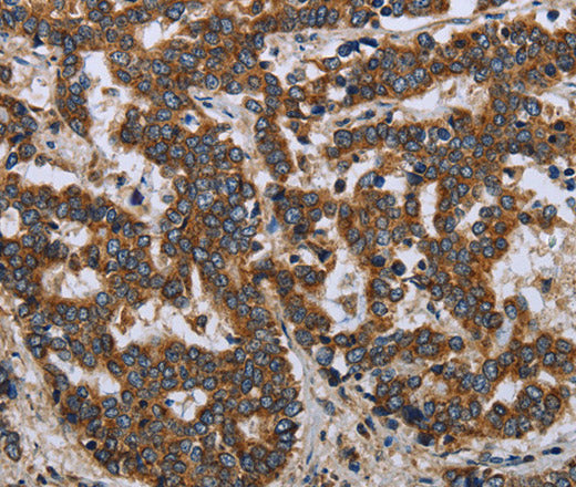 LGALS2 Polyclonal Antibody – Figure 1 of 3