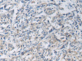 KCNJ10 Polyclonal Antibody – Figure 1 of 2