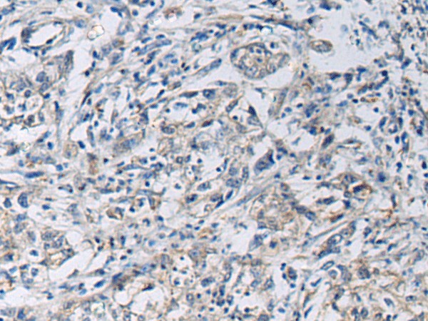 KCNJ10 Polyclonal Antibody – Figure 1 of 2